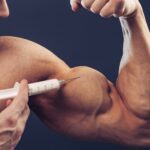 steroid injection sites