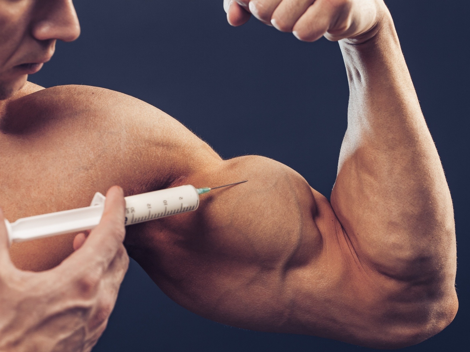 steroid injection sites